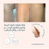 سنفرة شعاع الشمس سنفرة شعاع الشمس